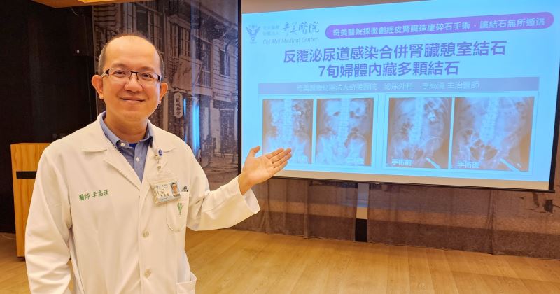 【反覆泌尿道感染合併腎臟憩室結石，7旬婦體內藏多顆結石  奇美醫院採微創經皮腎臟造廔碎石手術，讓結石無所遁逃】