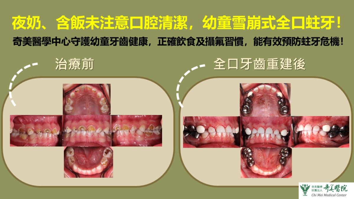 新聞圖片